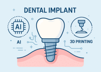 Dental Implant