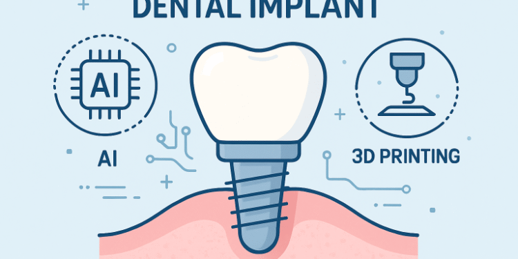 Dental Implant