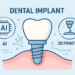 Dental Implant